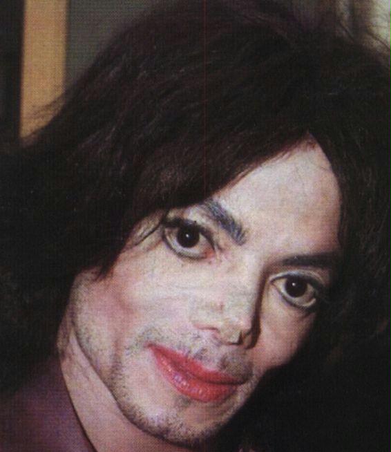 Ужасная операция. Michael Jackson отвалился нос. У Майкла Джексона отвалился нос.