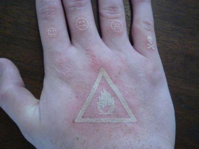 Laser Tattoo