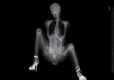 X-Ray Pinup Kalender