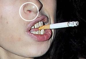 Amy Winehouse's scarlet nose hints that recent troubles are taking their toll